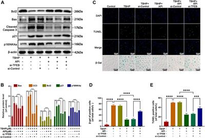 Apigenin Alleviates Intervertebral Disc Degeneration via Restoring Autophagy Flux in Nucleus Pulposus Cells